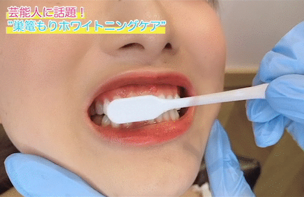 sugomori