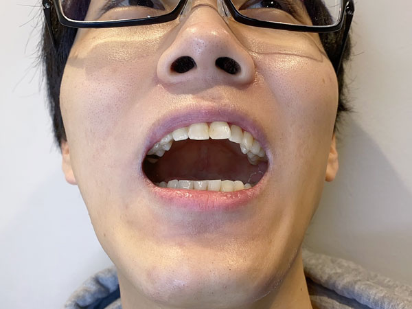 gaba